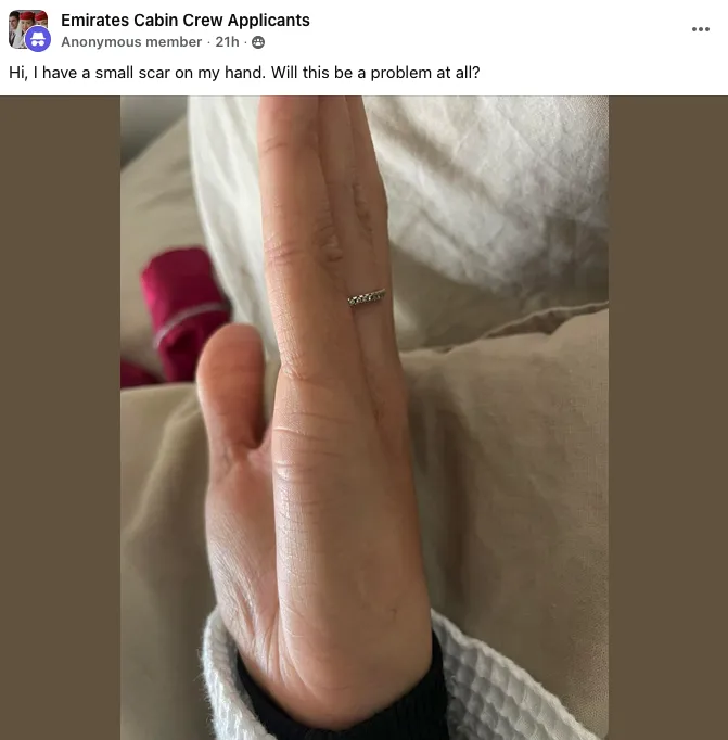 Emirates scar declarations are not subjective beauty measurements